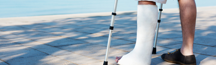 Man with broken leg by a swimming pool